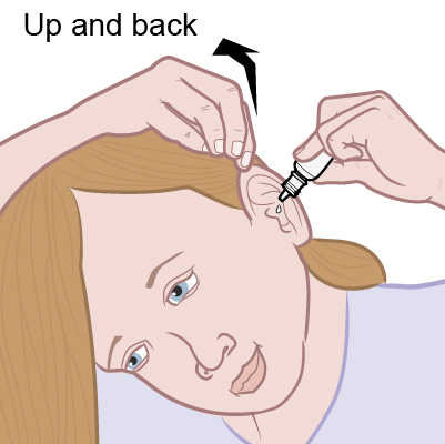 instructions for ciprodex otic drops